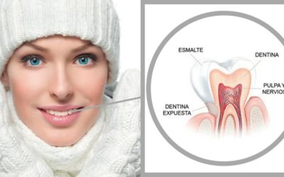 Sensibilidad dental